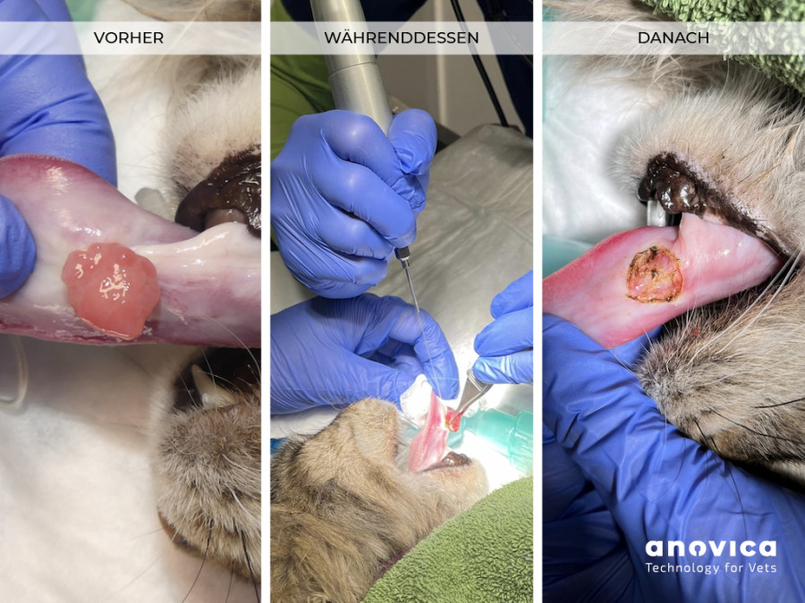anovica_Webshop_Dentallaser-FallbeispielUDlM7lh3T6uqA